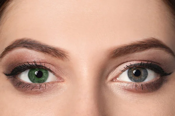 Mujer Con Diferentes Colores Ojos Primer Plano Heterocromia Iridis — Foto de Stock