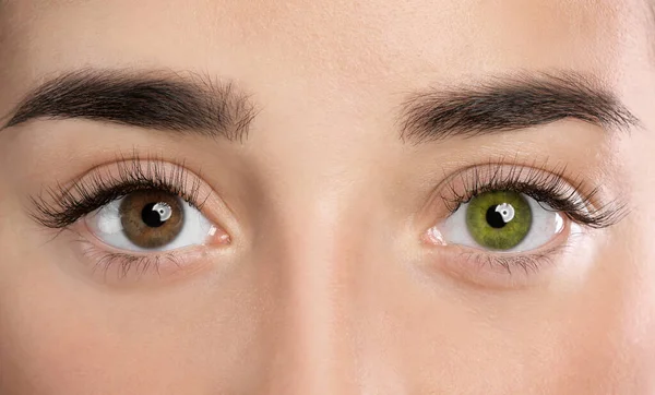 Farklı renkte gözleri olan bir kadın, yakın plan. Heterokromi iridis