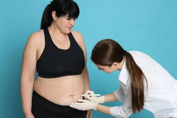 Doktor Açık Mavi Arka Planda Obez Kadının Vücuduna Izler Çiziyor — Stok fotoğraf