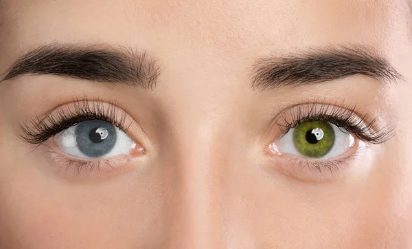 Žena Různými Barvami Očí Detailní Záběr Heterochromia Iridis — Stock fotografie