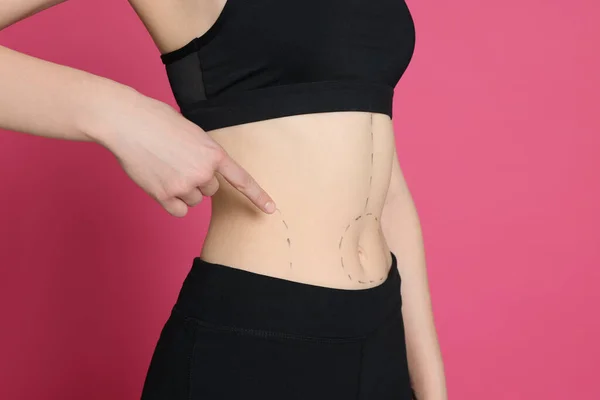 Slim Woman Marks Body Pink Background Closeup Weight Loss Surgery — 스톡 사진