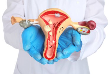 Jinekolog, beyaz arka planda kadın üreme sisteminin modelini tutuyor.