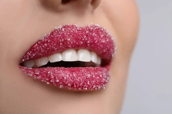 Mujer Joven Con Hermosos Labios Cubiertos Azúcar Sobre Fondo Claro — Foto de Stock