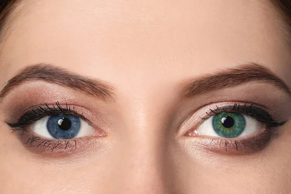 Woman Different Colors Eyes Closeup Heterochromia Iridis — Fotografia de Stock
