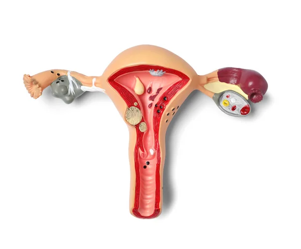 Model Female Reproductive System Isolated White Top View Gynecological Care — Stock Photo, Image