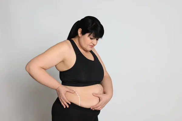 Obese Woman Marks Body Light Background Space Text Weight Loss — Stok fotoğraf