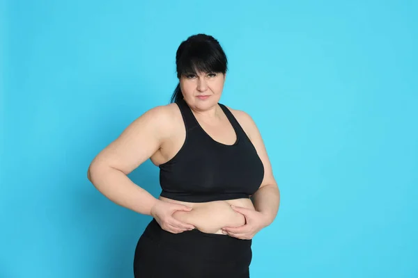 Fettleibige Frau Auf Hellblauem Hintergrund Operation Zur Gewichtsreduktion — Stockfoto
