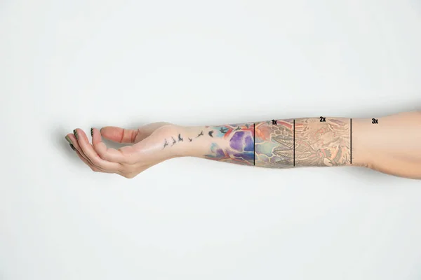 Mulher Antes Depois Procedimentos Remoção Tatuagem Laser Fundo Branco Close — Fotografia de Stock