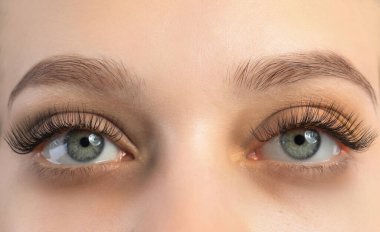 Tired young woman with dark circles under eyes, closeup