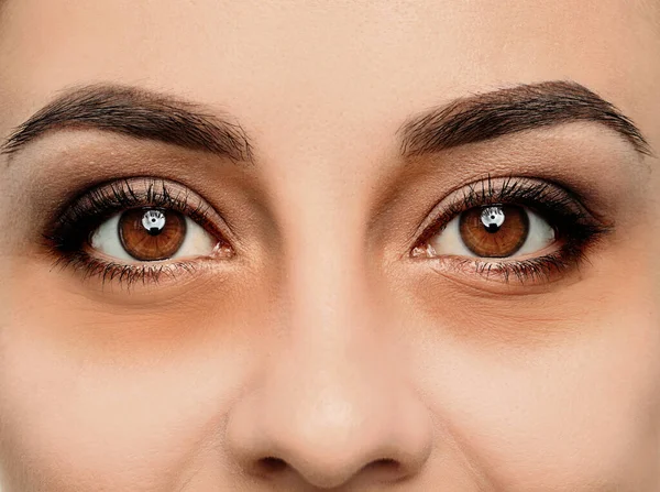 Tired Young Woman Dark Circles Eyes Closeup — Stockfoto