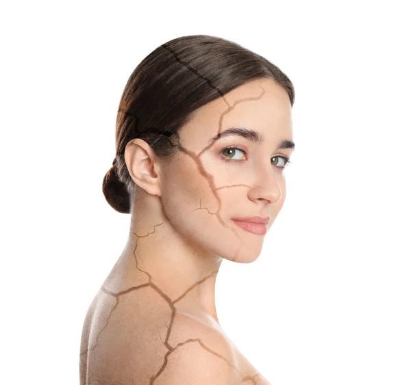 Young Woman Body Dry Skin Problem White Background — Zdjęcie stockowe