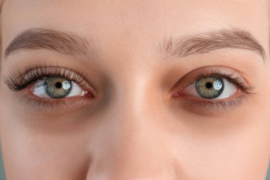 Tired young woman with dark circles under eyes, closeup