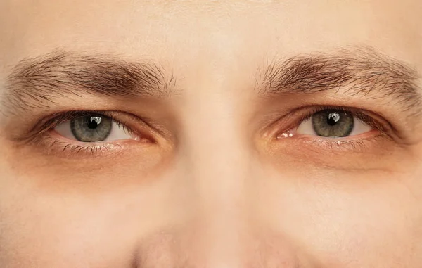 Uomo Stanco Con Occhiaie Sotto Gli Occhi Primo Piano — Foto Stock