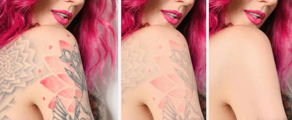 Woman Laser Tattoo Removal Procedures Closeup Collage Photos Banner Design — Stok fotoğraf