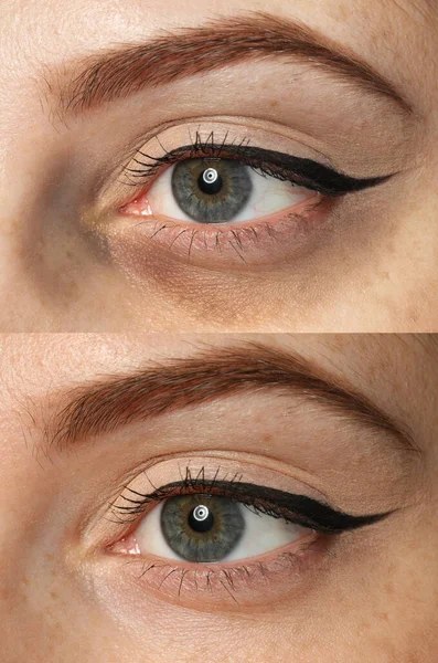 Göz altı koyu halkalı yorgun kadınların fotoğraflarıyla kolaj, ve dinlendikten sonra, yakın plan.