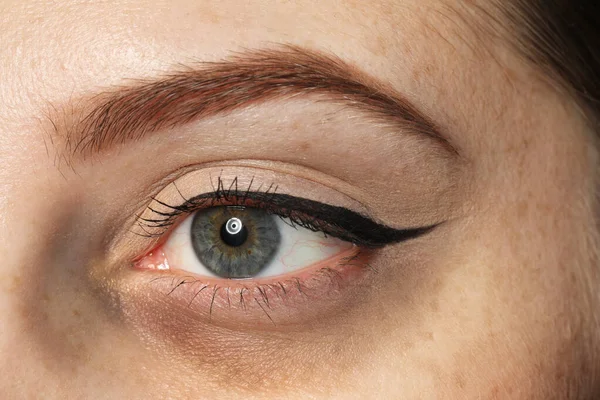 Tired Young Woman Dark Circle Eye Closeup — Stock Photo, Image