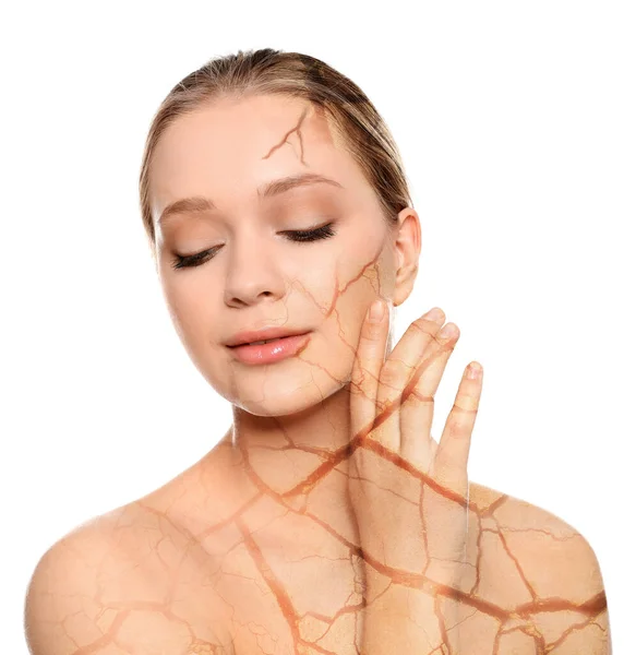 Young Woman Body Dry Skin Problem White Background — Foto de Stock