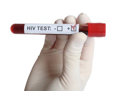 Bilim adamları, üzerinde kan örneği olan tüp tutuyorlar ve beyaz arka plan üzerinde HIV testi etiketliyorlar.