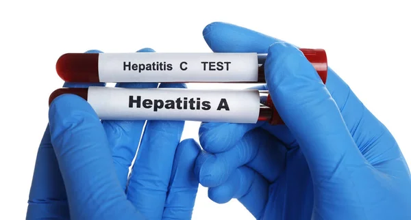 Cientista Segurando Tubos Com Amostras Sangue Para Teste Vírus Hepatite — Fotografia de Stock