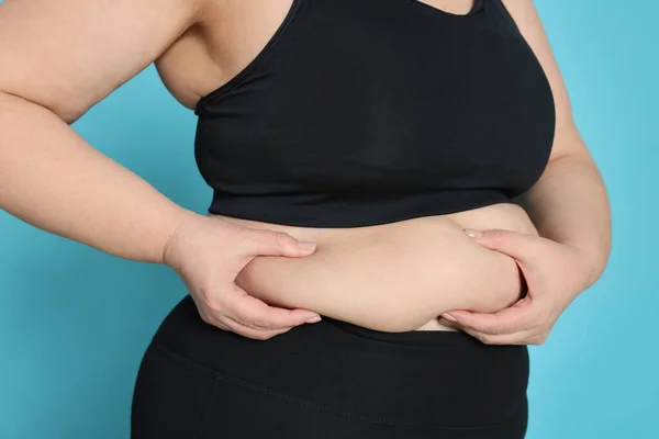 Obese Woman Light Blue Background Closeup Weight Loss Surgery — Stock Photo, Image