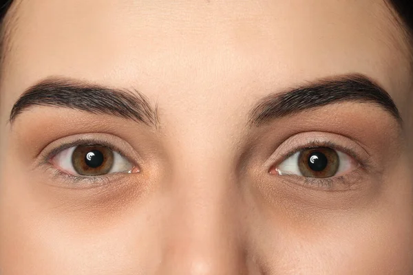 Tired Young Woman Dark Circles Eyes Closeup — Stockfoto