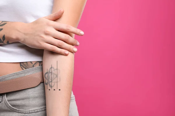 Kvinna Före Och Efter Laser Tatuering Borttagning Förfaranden Rosa Bakgrund — Stockfoto
