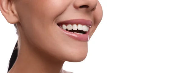 Beyaz Arka Planda Sağlıklı Dişleri Olan Genç Bir Kadının Yakın — Stok fotoğraf