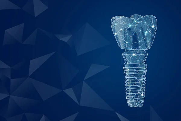 濃い青の背景に歯科インプラントのイラスト テキストのスペース — ストック写真