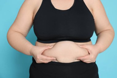 Açık mavi arka planda obez kadın, yakın plan. Kilo kaybı ameliyatı