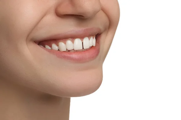 Üst Dişleri Arasında Diyastema Olan Beyaz Arka Planda Yakın Plan — Stok fotoğraf