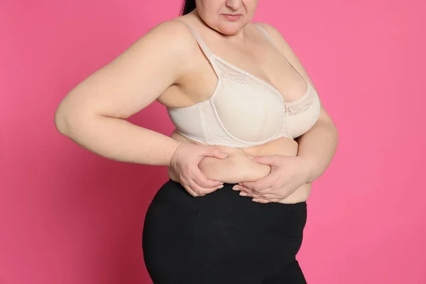 Obézní Žena Růžovém Pozadí Detailní Záběr Operace Hubnutí — Stock fotografie