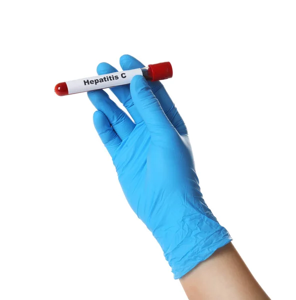 Wetenschapper Holding Tube Met Bloedmonster Label Hepatitis Witte Achtergrond Close — Stockfoto