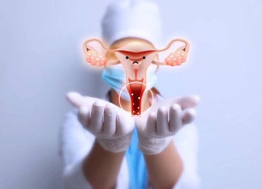 Doktor, enfekte olmuş dişi üreme sisteminin görüntüsünü ışık arka planında, yakın planda gösteriyor. Vajinal Candiasis