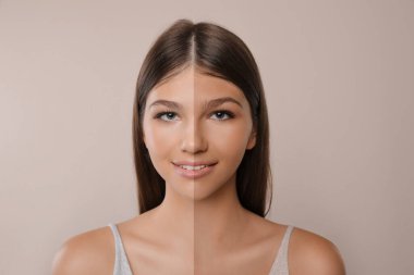 Bej arkaplanda bronzlaşmadan önce ve sonra güzel bir kızın fotoğraflarıyla kolaj