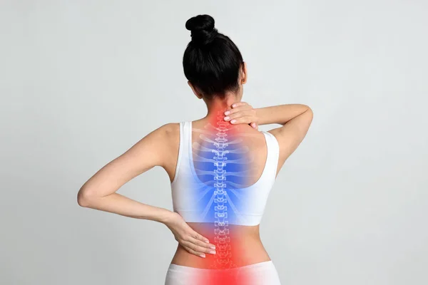 Frau Leidet Unter Rückenschmerzen Vor Hellem Hintergrund — Stockfoto