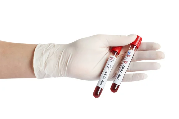 Cientista Segurando Tubos Com Amostras Sangue Etiquetas Teste Hiv Fundo — Fotografia de Stock
