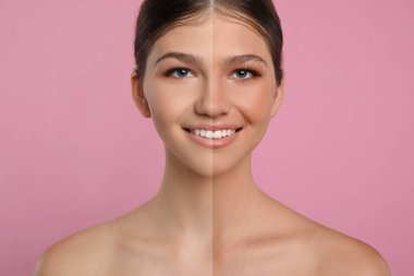 Pembe arka planda bronzlaşmadan önce ve sonra güzel kızların fotoğraflarıyla kolaj.