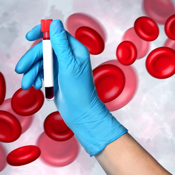 Wissenschaftler Mit Handschuhen Reagenzglas Mit Blutprobe Und Darstellung Von Erythrozyten — Stockfoto