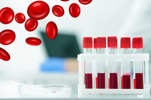 Laboratuvarda Kan Örnekleriyle Test Tüpleri Eritrosit Örnekleri — Stok fotoğraf