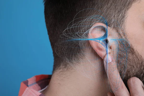 難聴の概念 人と音の波のイラストは ライトブルーの背景に クローズアップ — ストック写真