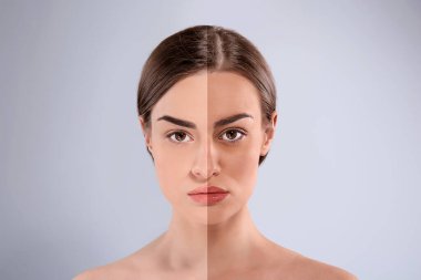 Açık gri arkaplanda bronzlaşmadan önce ve sonra güzel genç bir kadının fotoğraflarıyla kolaj.