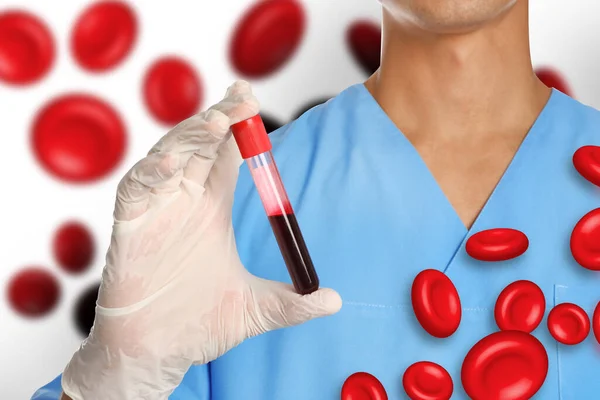 Doctor Holding Test Tube Blood Sample Illustration Erythrocytes White Background — Stockfoto