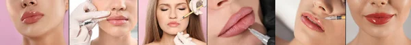 Collage Photos Women Procedures Lip Augmentation Permanent Makeup Closeup Banner — Stok fotoğraf