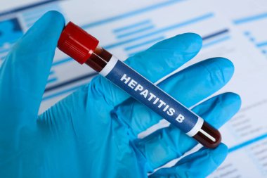 Laboratuvar test formuna karşı üzerinde kan örneği olan tüp ve Hepatit B etiketi tutan bilim adamı, yakın plan.