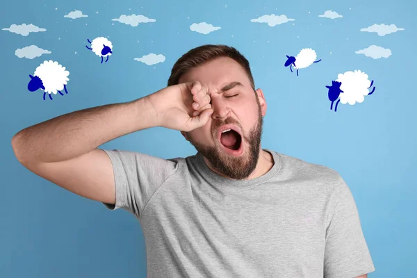 Sleepy Young Man Yawning Pictures Sheep Light Blue Background — Foto de Stock