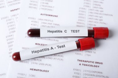 Hepatit virüsü testi için kan örnekleri olan tüpler laboratuvar formunda, yakın plan.