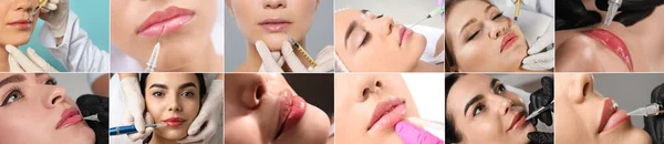 Colagem Com Fotos Mulheres Durante Procedimentos Aumento Lábios Maquiagem Permanente — Fotografia de Stock