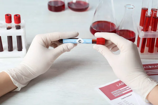 Scientist Holding Tube Blood Sample Label Hepatitis Test White Wooden — Stok fotoğraf