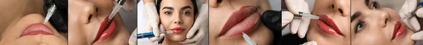 Colagem Com Fotos Mulheres Durante Procedimentos Aumento Lábios Maquiagem Permanente — Fotografia de Stock
