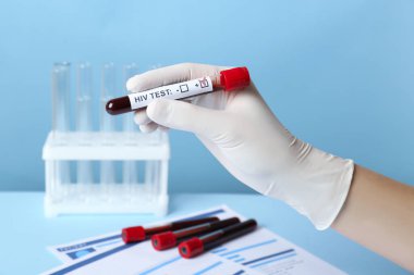Bilim adamları, üzerinde kan örneği olan bir tüp tutuyor ve açık mavi arkaplan üzerinde HIV testi yapıyor.